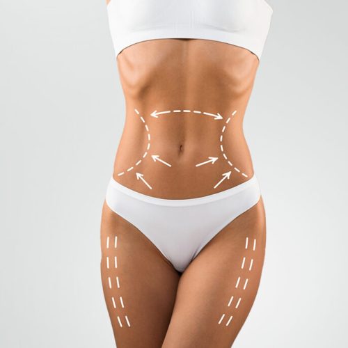 Abdominoplastia-JPG-1024x683